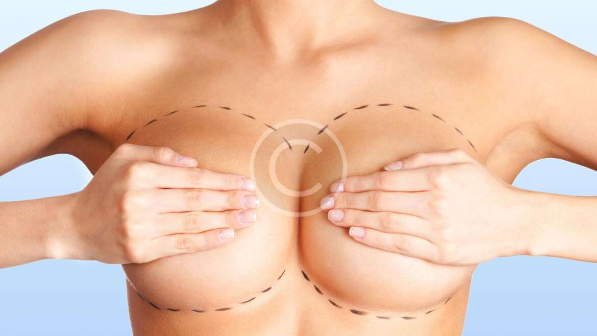 5 Things You Should Know Before Breast Augmentation Surgery