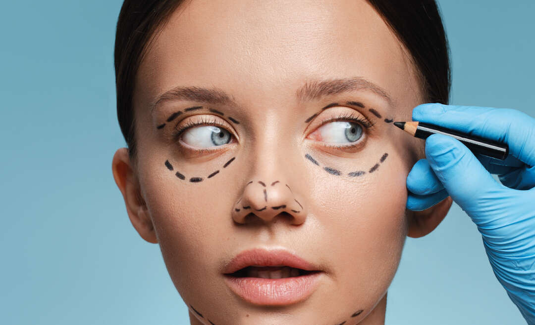 Blepharoplasty Cost
