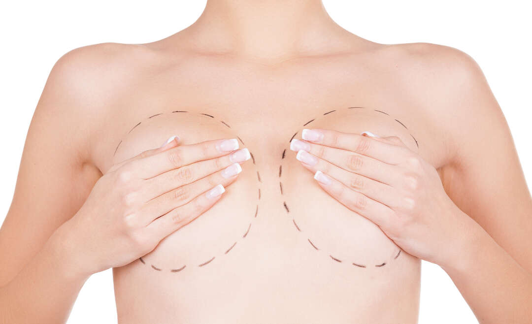 Mammoplasty Cost