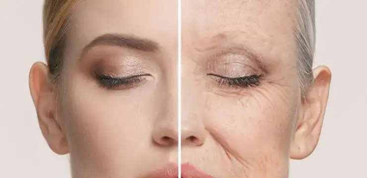 Turkey Facelift for Women in their 40s