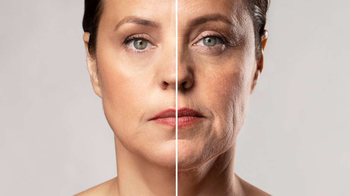 5 Signs of Facial Aging