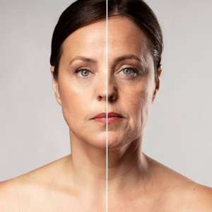 5 Signs of Facial Aging