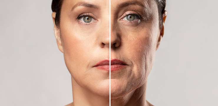 5 Signs of Facial Aging
