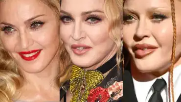 Madonna Plastic Surgery