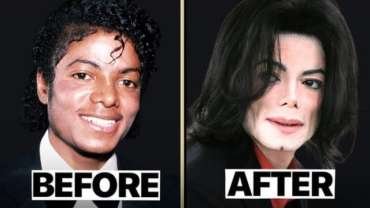 Michael Jackson Nose Job