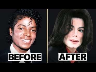 Michael Jackson Nose Job