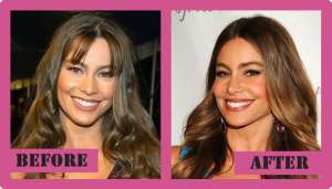 Did Sofia Vergara Get Plastic Surgery