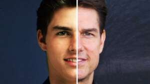Tom Cruise Facial Plastic Surgeries