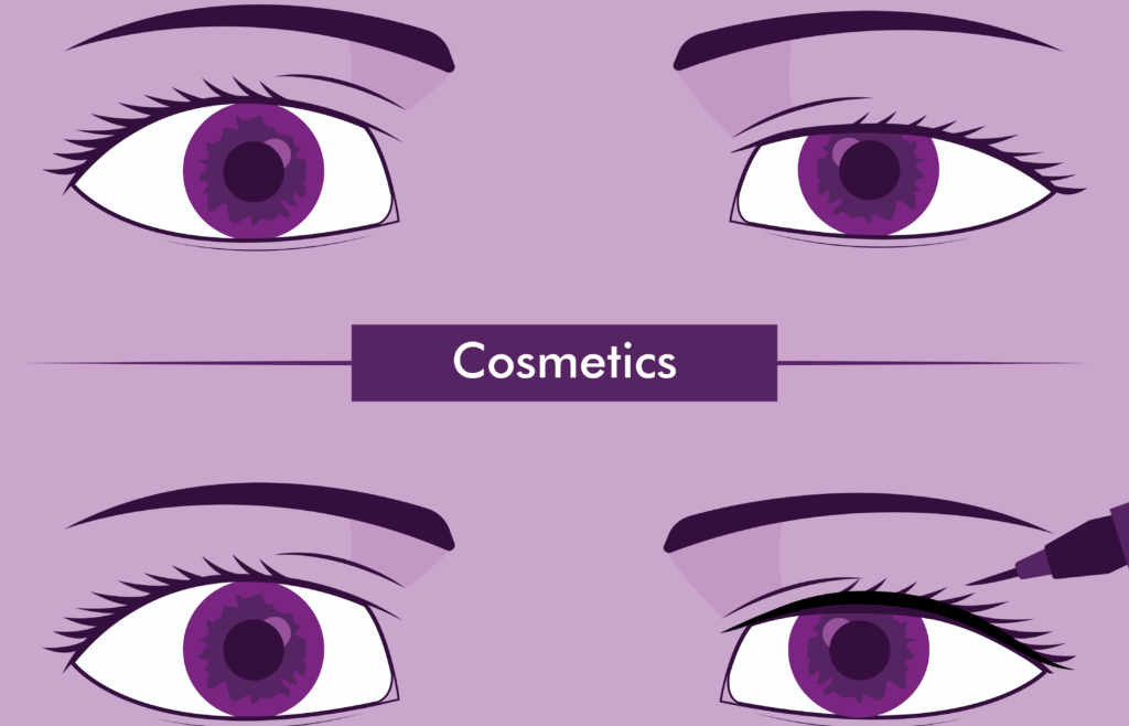 Asymmetrical Eyelids and Treatment Options