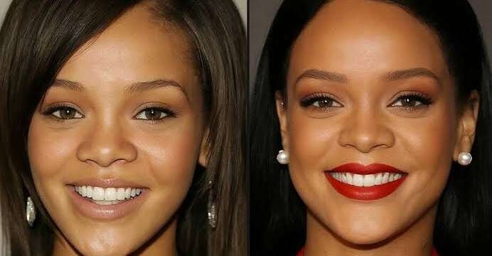 Did Rihanna Have Plastic Surgery?