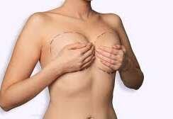 Plastic Surgery Breast Lift in Turkey