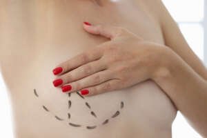 Breast Augmentation Surgery in Turkey